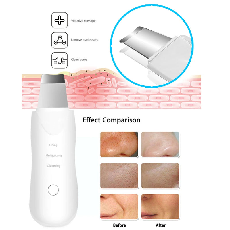 ULTRASONIC DEEP VIBRAR SKIN SCRUBBER