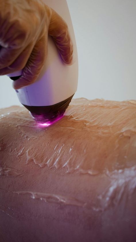 Depilador á Laser Profissional